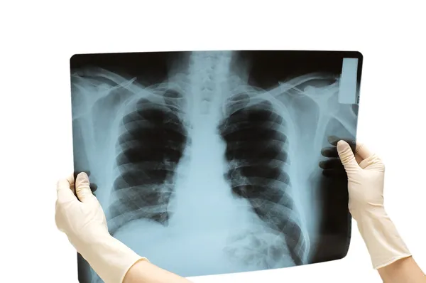 Twee handen met x-ray afbeelding — Stockfoto