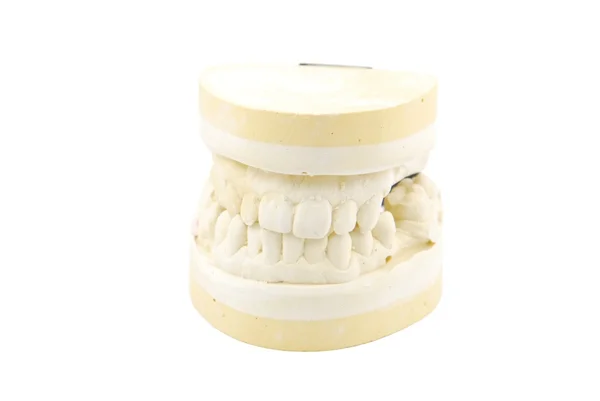 Studienmodell für Zahnersatz — Stockfoto