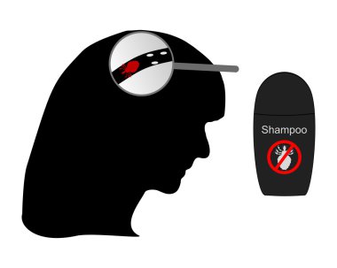 Head of woman, louse, nit and lice shamp clipart