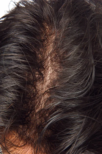 Rambut palsu — Stok Foto