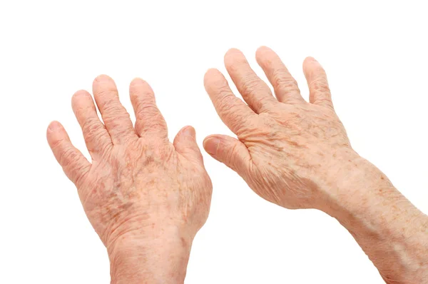 Mãos velhas sobre um fundo branco — Fotografia de Stock