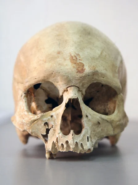 Skull of man — Stock Photo, Image