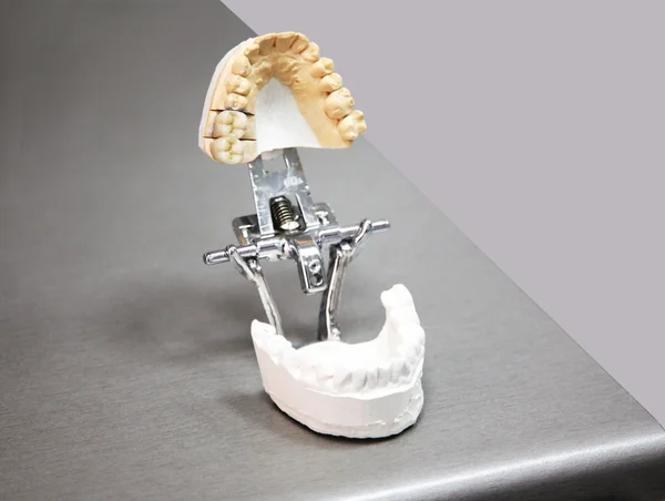 义齿修复肢体制造 — 图库照片