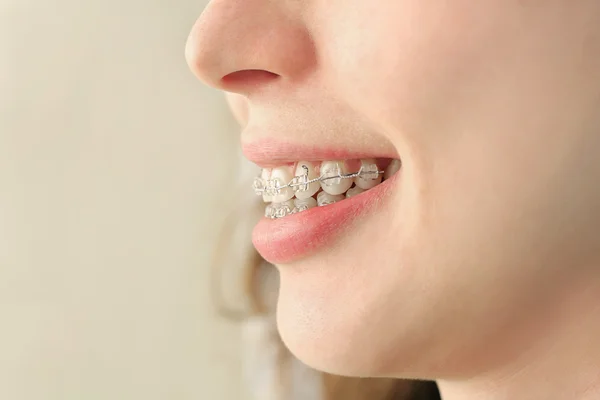 Girl smiles with braces — Stock Photo, Image