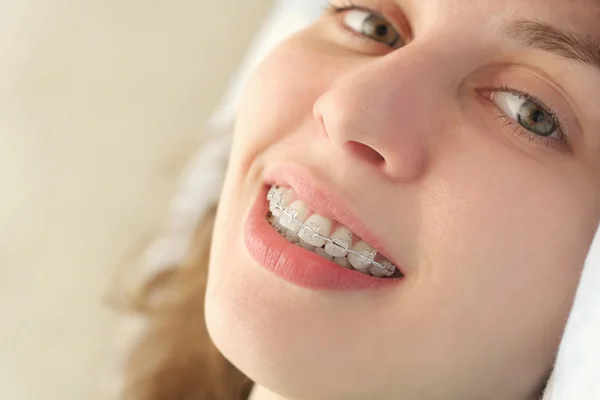 Diş teli ile kız gülümsüyor Telifsiz Stok Imajlar