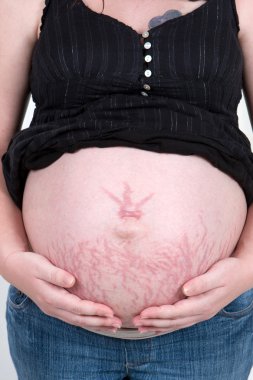 Stretch Marks clipart