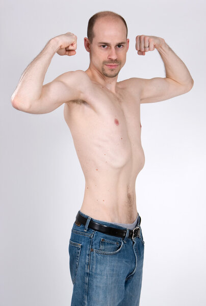 Человек-скакун
