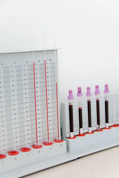 Portagens laboratoriais para exame de sangue — Fotografia de Stock