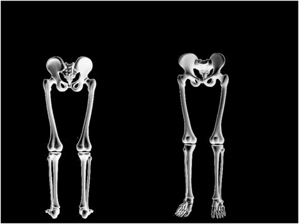 Esqueleto Imagen De Stock