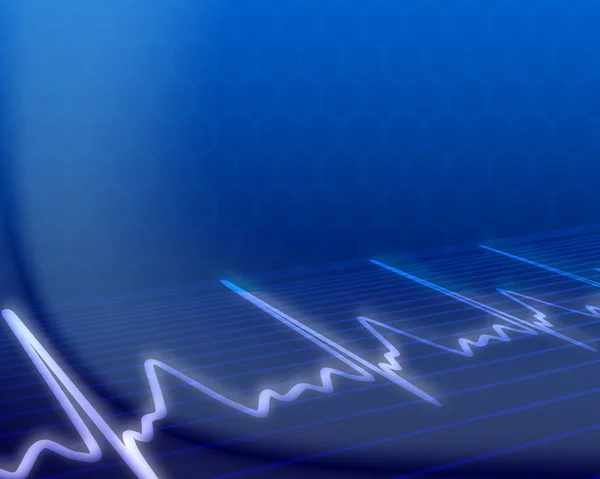 Cardiograma eletrônico em segundo plano — Fotografia de Stock