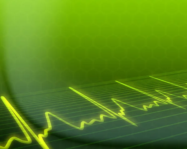 Electronic cardiogram on background — Stock Photo, Image