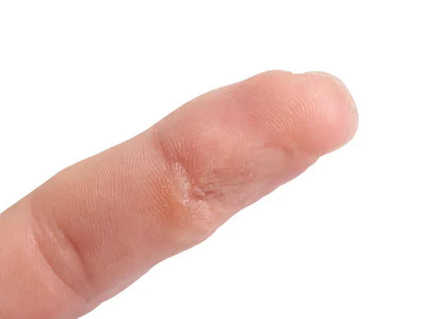 人的手指与损坏皮革 — 图库照片