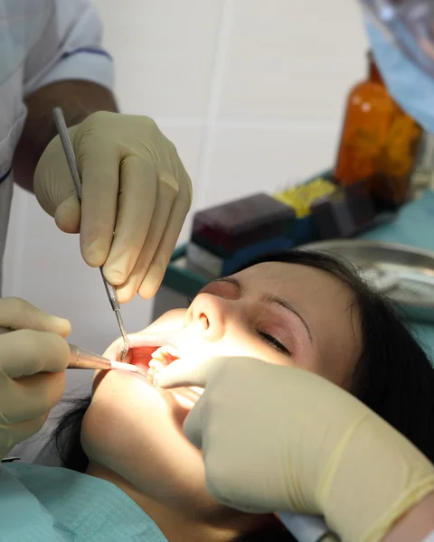 Der Zahnarzt behandelt einen Zahn mit speziellen Werkzeugen — Stockfoto