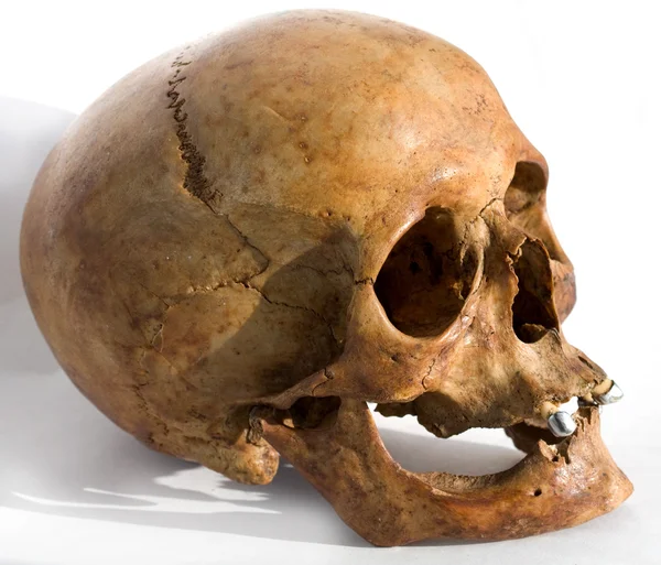 stock image Human skull