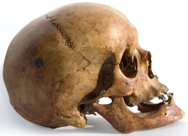 Stock image Human skull