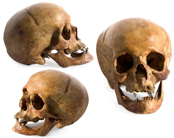 Древний человеческий череп в трёх измерениях — стоковое фото