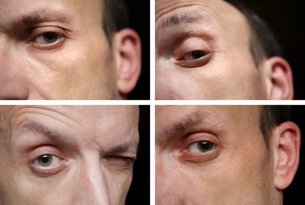 Quatro olhos de homem — Fotografia de Stock