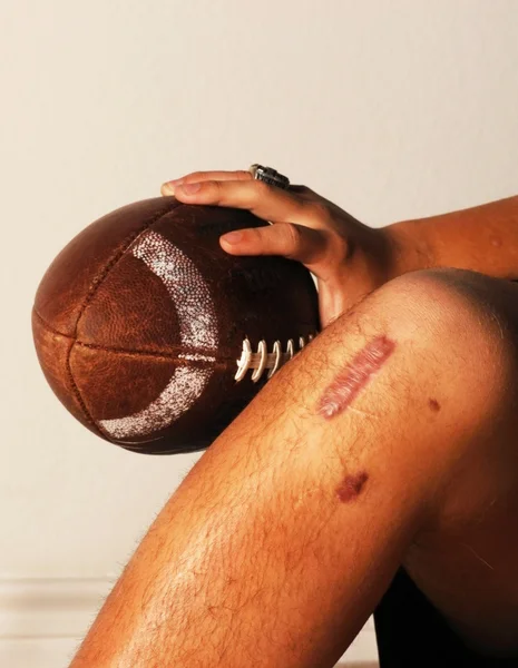 ACL futbol yaralanması — Stok fotoğraf