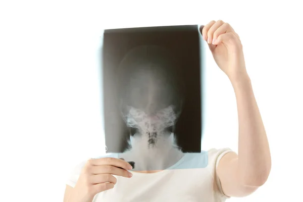 X 線写真のスキャン — ストック写真