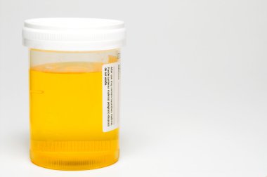 Urine Sample clipart