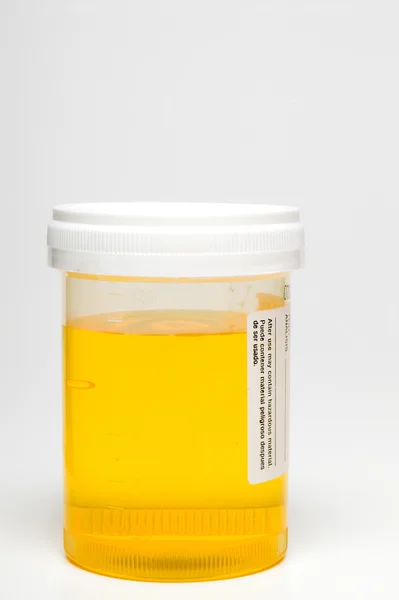 Amostra de urina — Fotografia de Stock
