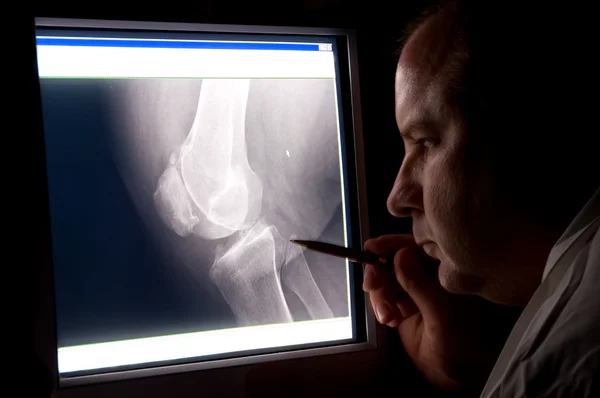 Arzt röntgen — Stockfoto