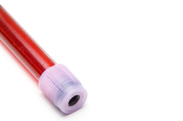 혈액 샘플 — 스톡 사진
