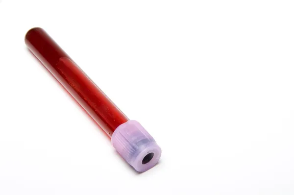Vzorky krve — Stock fotografie