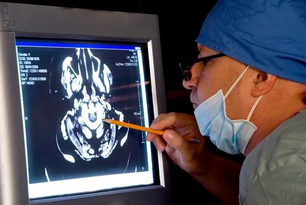 Сканирование мозга — стоковое фото
