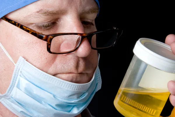 Espécime de urina — Fotografia de Stock