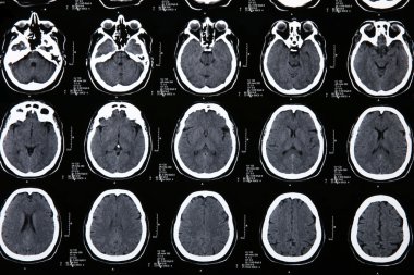 Magnetic resonance of a brain clipart