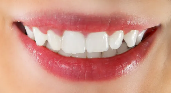 Denti bianchi sani — Foto Stock