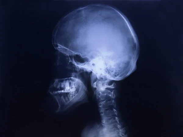 Людського черепа Ліцензійні Стокові Зображення