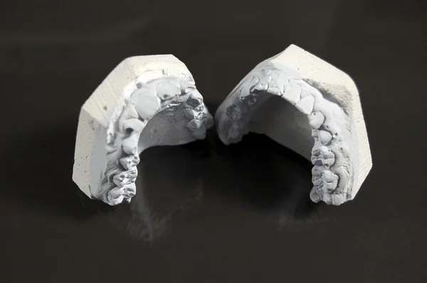 Modell av tand — Stockfoto