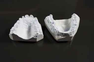 Model of tooth clipart