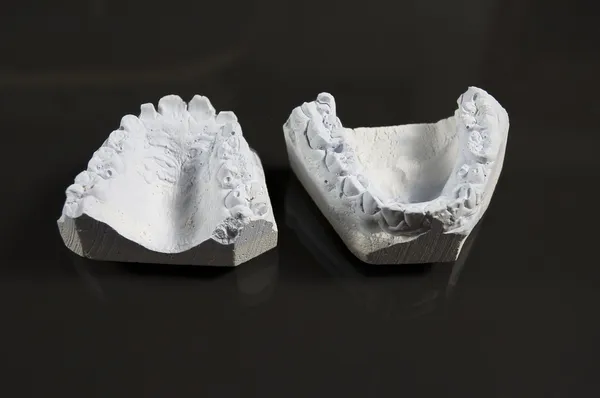 Modèle de dent — Photo