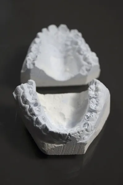 Model of tooth — Stock Photo, Image