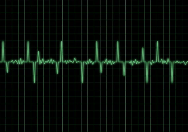 Frequenza cardiaca — Foto Stock