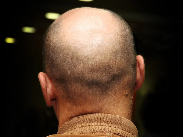 Plešatý hlavy starší muž — Stock fotografie