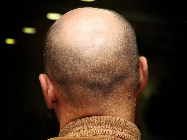Plešatý hlavy starší muž Stock Snímky