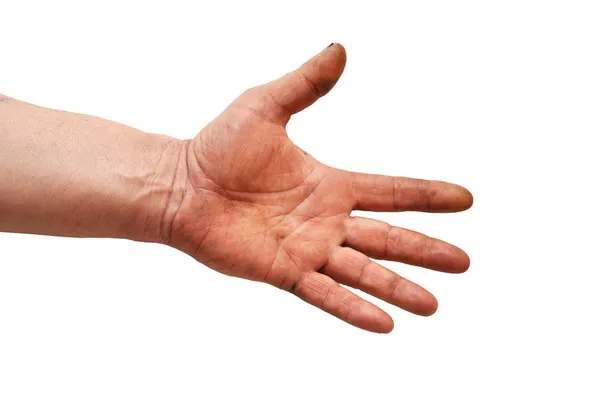 Piszkos kéz. — Stock Fotó