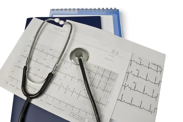 Medische stethoscoop op cardiogram — Stockfoto