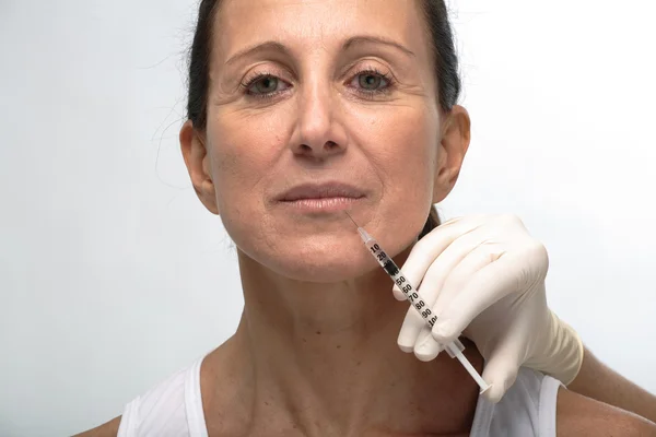Tratamento cosmético com injeção de botox — Fotografia de Stock