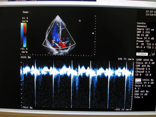 Kolorowy monitor układu sercowo-naczyniowego, wyświetlacz — Zdjęcie stockowe