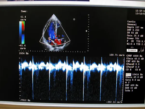 Színes szív-és érrendszeri monitor, kijelző Jogdíjmentes Stock Fotók