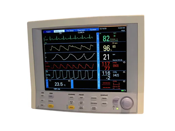 Barevný kardiovaskulární monitor, displej — Stock fotografie