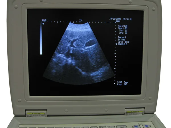 Monitor cardiovascular Doppler, digital — Fotografia de Stock