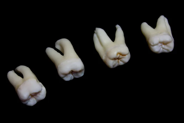 Вырезанные человеческие зубы — стоковое фото