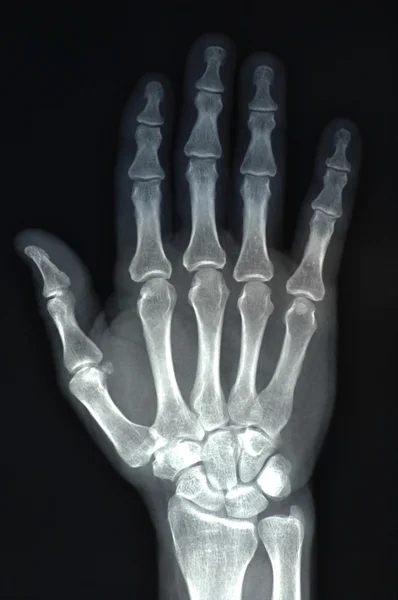Röntgensugár Stock Kép