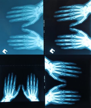 X-ray scanning clipart